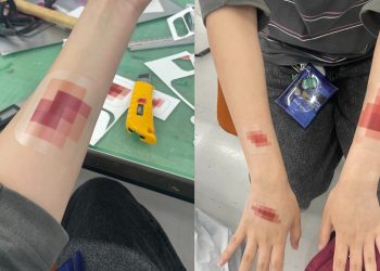 Plester Luka Kreator Jepang